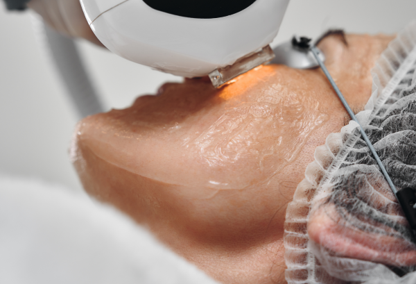 INJECTABLE TREATMENTS