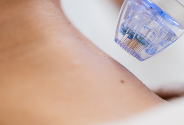 INJECTABLE TREATMENTS